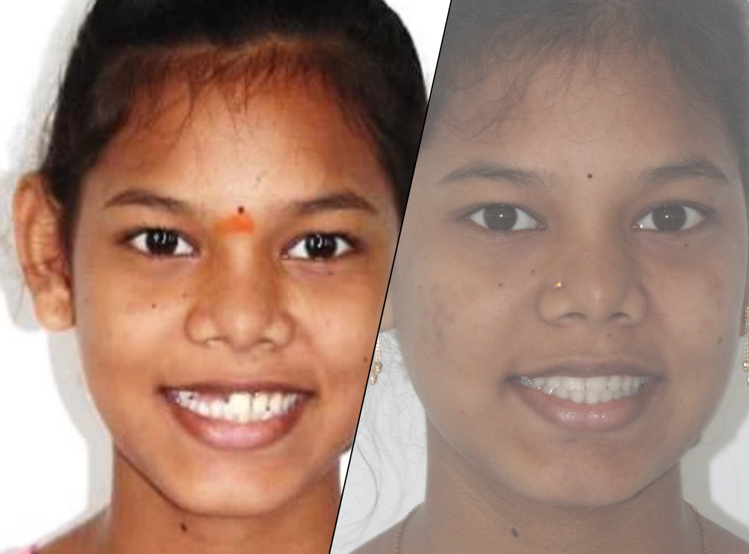 Bhargavi story